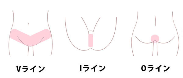 VIO